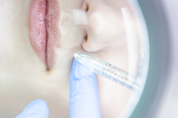 factors-influencing-the-number-of-units-of-botox Lip Flip Treatment Using Botox