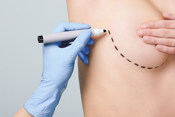 what-is-the-process-of-a-breast-lift Risks & Considerations of Mastopexy