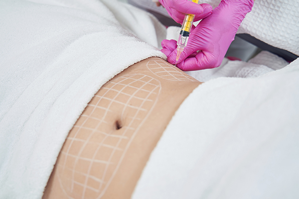 Side Effects of Liposuction