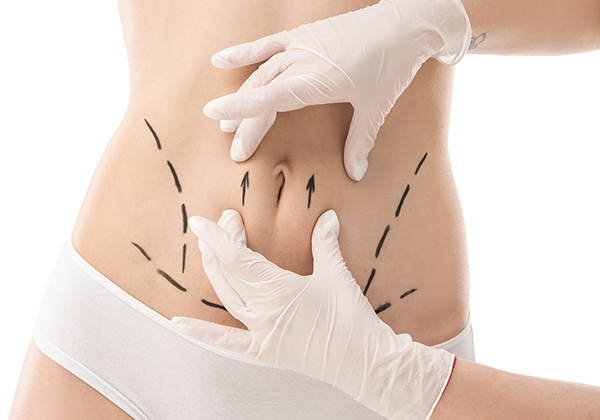 Liposuction and Health Status