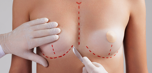 what-Is-Breast-Implant-Illness What Is Breast Implant Illness?<br />