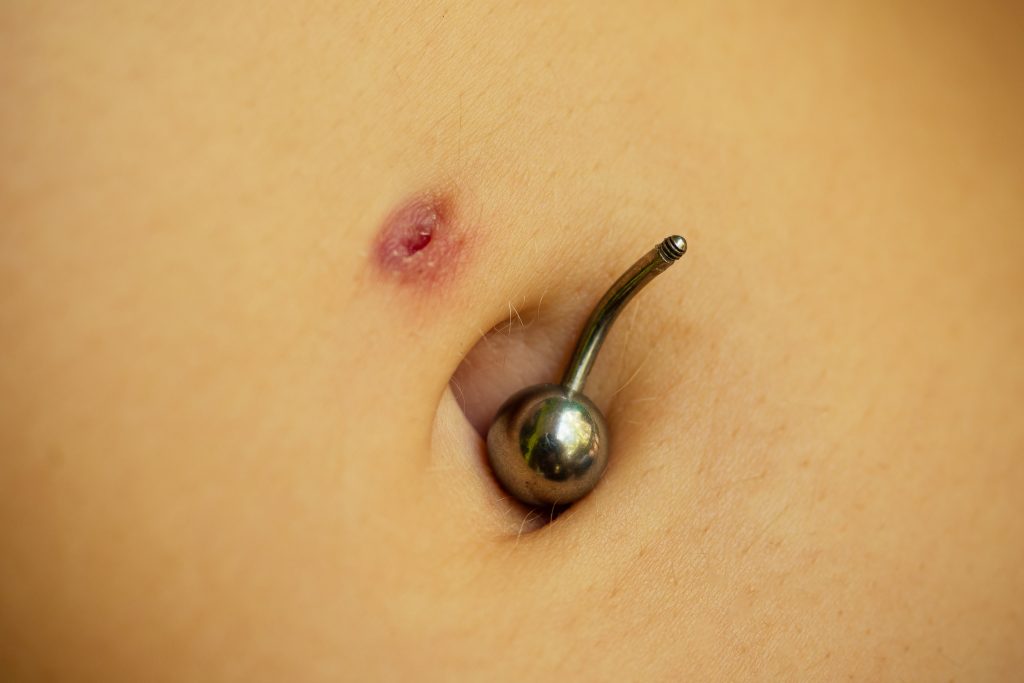 Belly Button Ring Scar