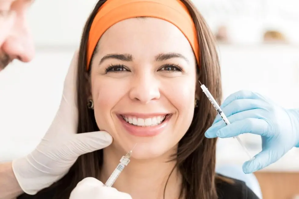 Filler in Smile Lines Before & After