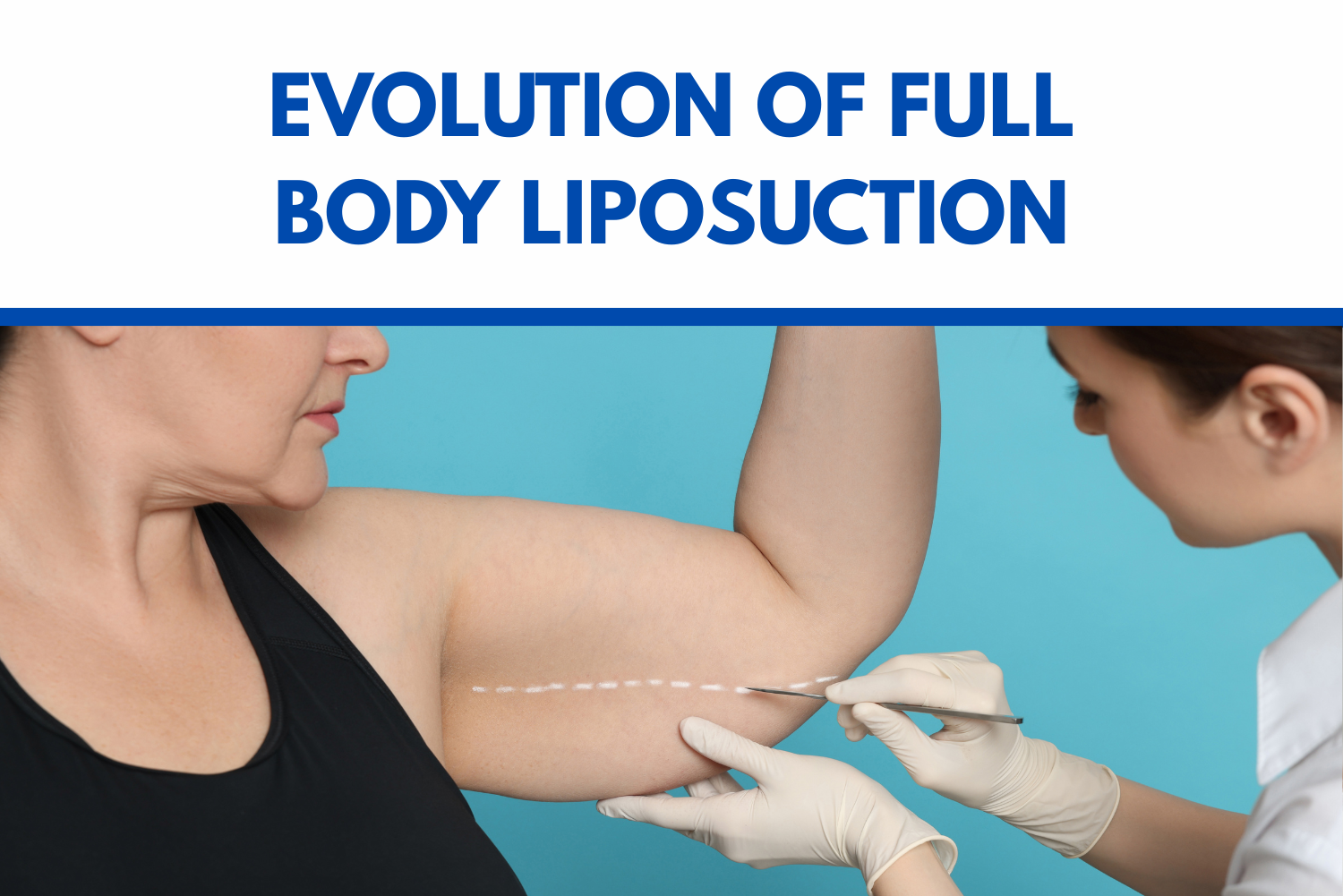 Evolution of Full Body Liposuction<br />
