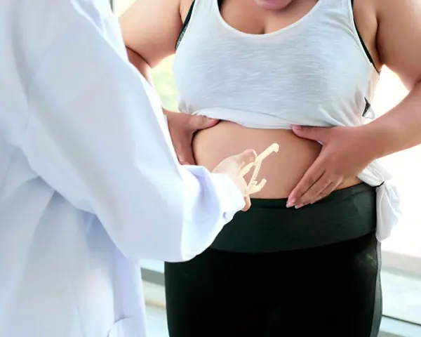 Diet & Exercise for Body Contouring Procedures