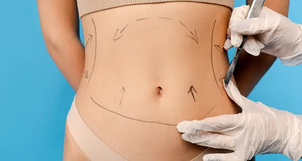 Strength Training & Fat Loss After Liposuction