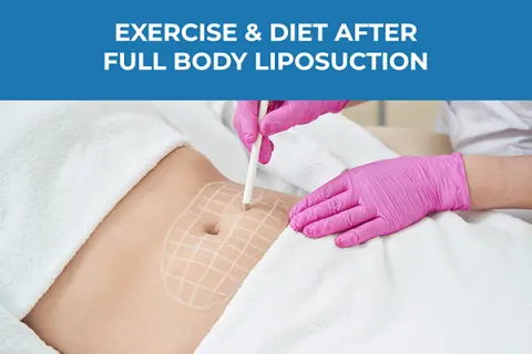 Role of Exercise & Diet After Full Body Liposuction