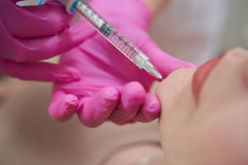 Injectable filler touch-up timeline explained by Dr Jim Brantner 