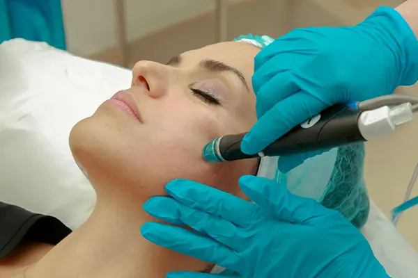 Wrinkle Reduction Laser Therapy Results