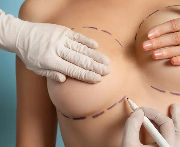 Emotional Factors in Aesthetic Procedures