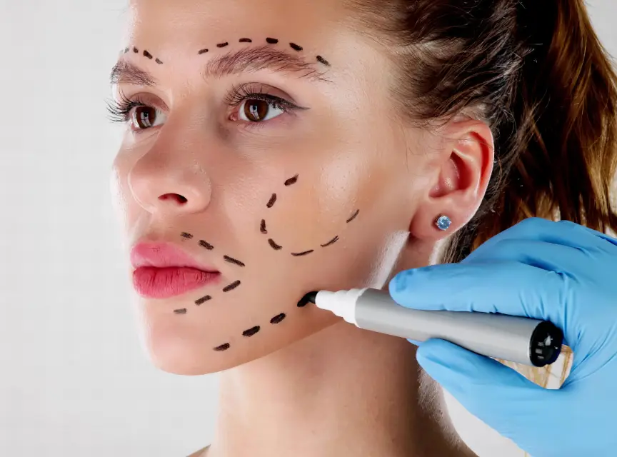 Facelift Surgery for Reducing Facial Wrinkles