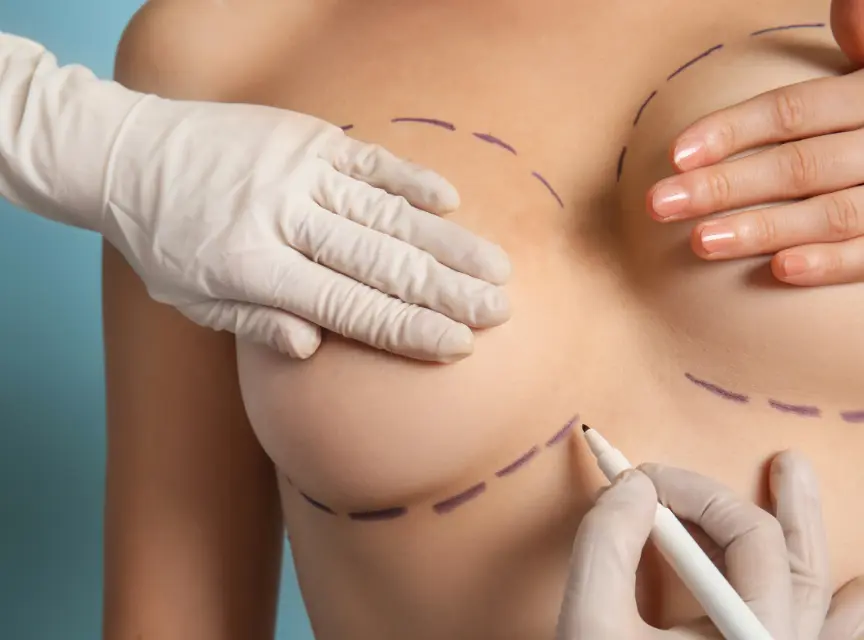 how-safe-is-breast-augmentation-surgery-johnson-city-tn How Safe Is Breast Augmentation Surgery Today
