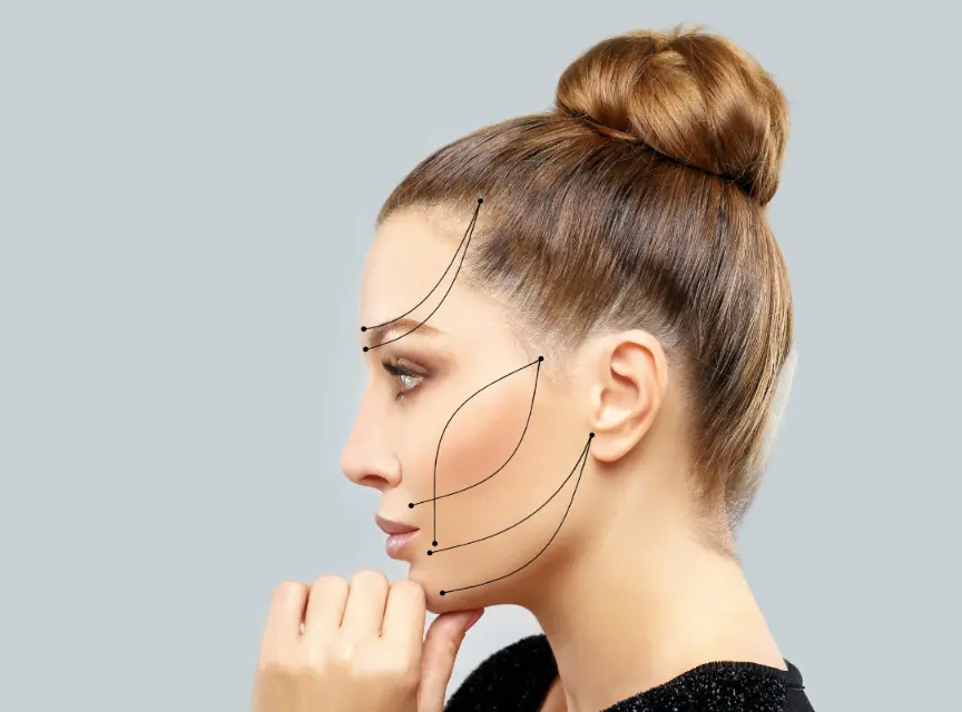 Facelift Surgeon Jim Brantner, MD