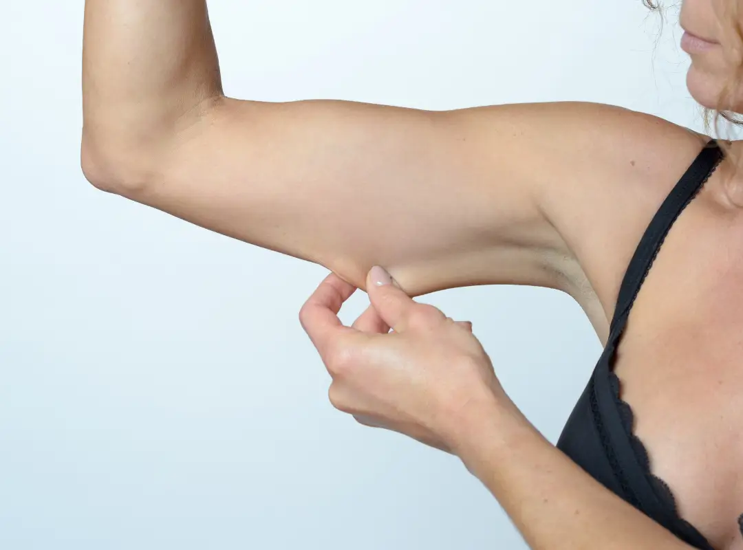 Does Compression Tighten Loose Skin