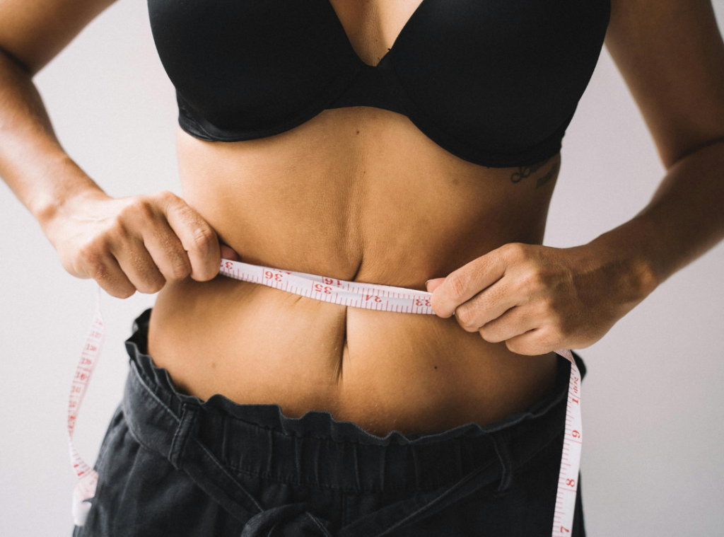 Abdominoplasty Scar