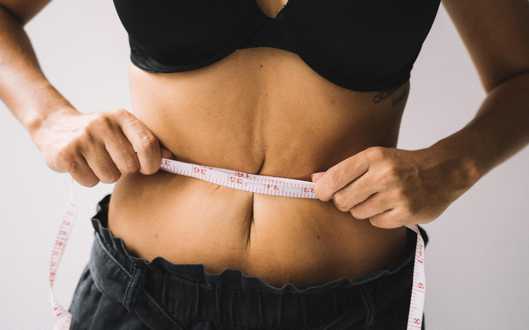 Abdominoplasty Scar