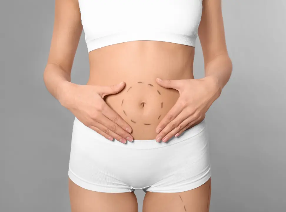 Should I Get a Mini or Full Tummy Tuck