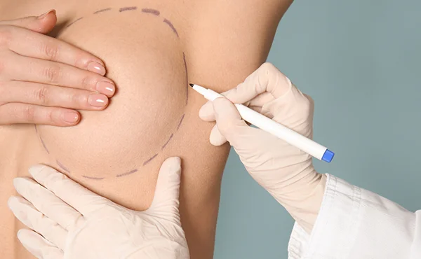 breast-reconstruction-surgery-options What Are the Different Types of Breast Reconstruction Surgery