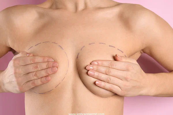 Jim Brantner MD Breast Lift Surgery Johnson City