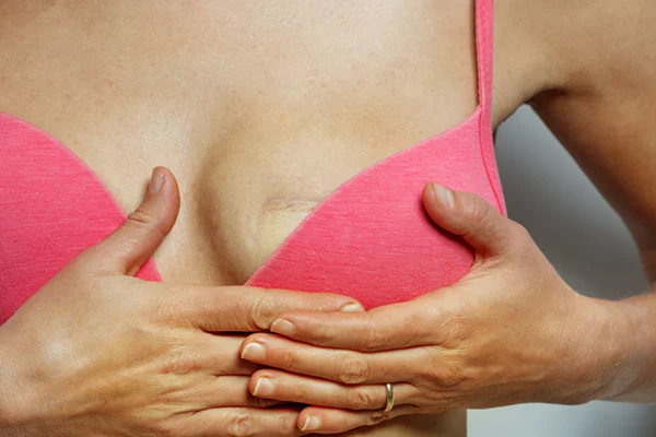 surgical-techniques-for-breast-reconstruction Surgical Techniques and Options for Breast Reconstruction