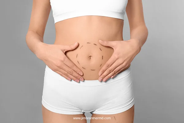 Jim Brantner, MD, Tummy Tuck, Johnson City, Tennessee