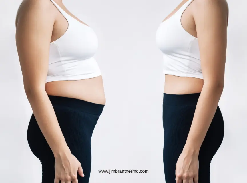 How to Lose Belly Fat After Breast Reduction