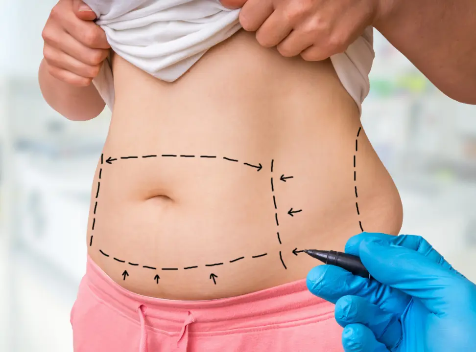Pros and Cons of Cosmetic Surgery