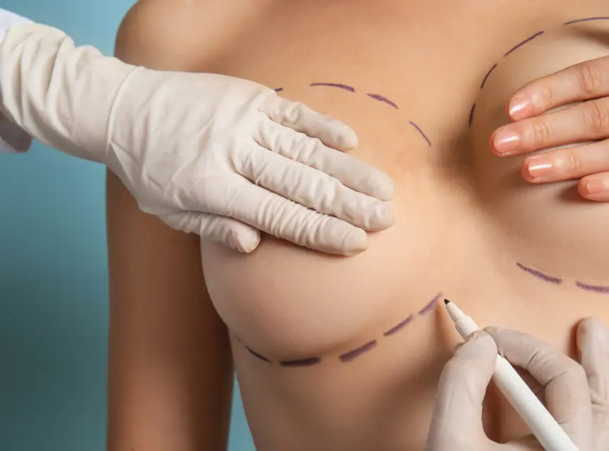 Jim Brantner, MD Breast Reduction Surgery