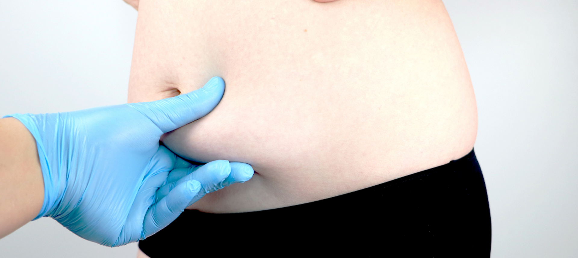 What Should You Expect During Tummy Tuck Recovery<br />
