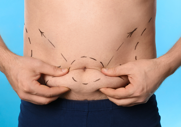 When Can You Return to Normal Activities After a Tummy Tuck<br />
