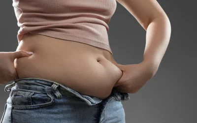 How Much Does SculpSure® Cost?